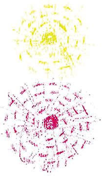 Figure 4. Patient drawing for halo/rings after a diffractive IOL.