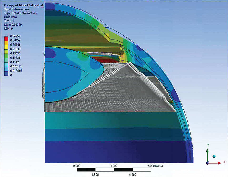 Figure 4. Zonules modeled as springs in a finite element eye model. From: AM Hipsley, Utilization of Novel 3D Virtual Eye Simulation Analyzer (VESA): a predictive tool for central optical power. Presentation at the 2022 American Society of Cataract and Refractive Surgery (ASCRS) meeting in Washington D.C.