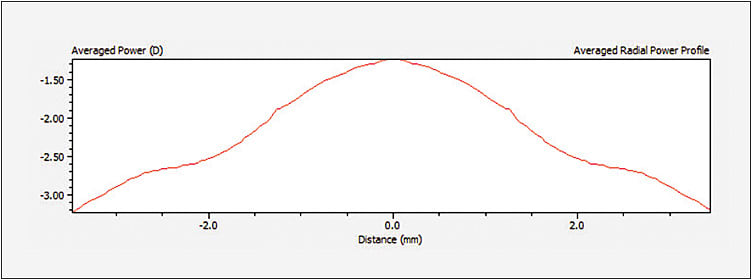 Figure 5. This center-near lens reaches full minus at 2.5mm from the center of the lens, a point much further into the periphery compared to the lenses in Figures 3 and 4.