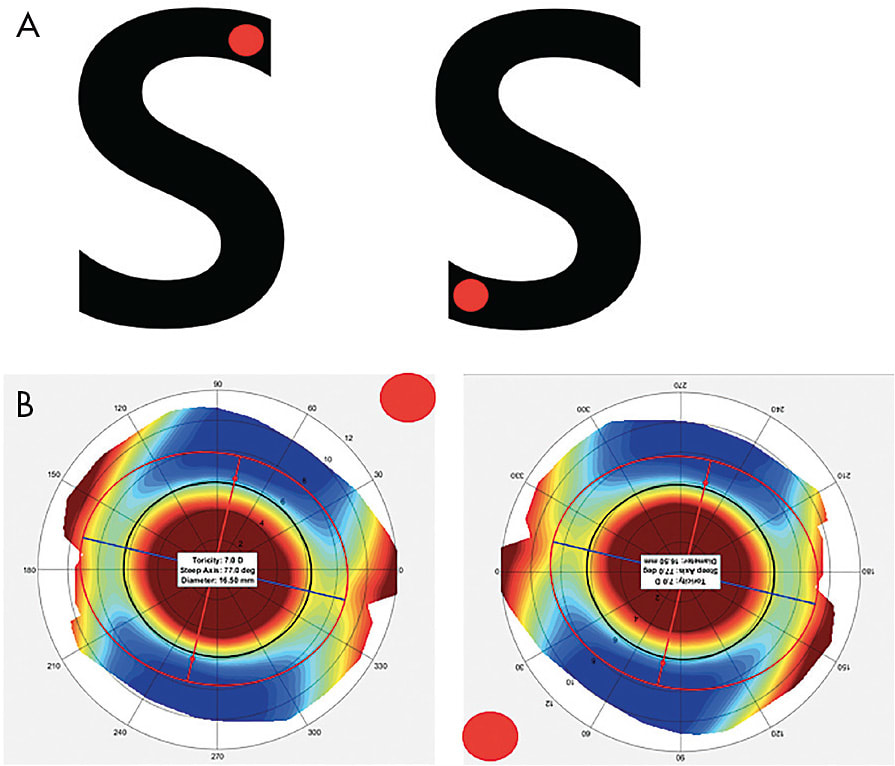 Figure 1. Rotationally symmetric shapes. The red dot represents the object rotating. Figure 1A shows a rotationally symmetric letter of order 2. Figure 1B shows a rotationally symmetric topography of a toric sclera of order 2. 
Figure 1B courtesy of Greg DeNaeyer, OD.