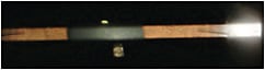Figure 2. Example of slit lamp beam utilizing both soft toric markings at 3 and 9 o’clock to measure rotation of contact lens. Aligning the slit lamp beam to both toric markings will provide a more accurate measurement of the contact lens rotation.