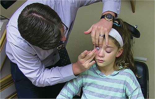 Use of contact lenses is one myopia control option for children.