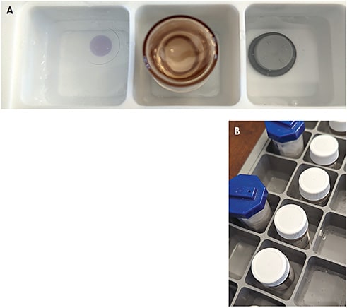 Figure 9. (A) Images of silicone ice cube trays and use of a three-compartment system for disinfection. The used lens soaks on the left, the lens case or vial is disinfected in the center, and the rubber stopper (if present) is disinfected on the right. All components soak in a commercially available micro-filtered 3% ophthalmic-grade hydrogen peroxide solution for three hours. This way all items are in the same row (lens, stopper, and vial) and will not be mixed up. (B) After three hours, specialty soft or hybrid designs are transferred to a neutralizing case filled with ophthalmic hydrogen peroxide for a complete six-hour cycle. The neutralizing case is kept in the ice cube tray to catch any overflow. In the workflow shown, the hybrid lenses soaking in ophthalmic hydrogen peroxide on the top were transferred to the neutralizing cases on the bottom. The disinfected vials in the center are waiting to have their solution discarded and then they will be rinsed with saline or MPS.