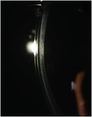 Figure 2B.