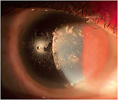 Figure 1. Surface non-wetting OD > OS.