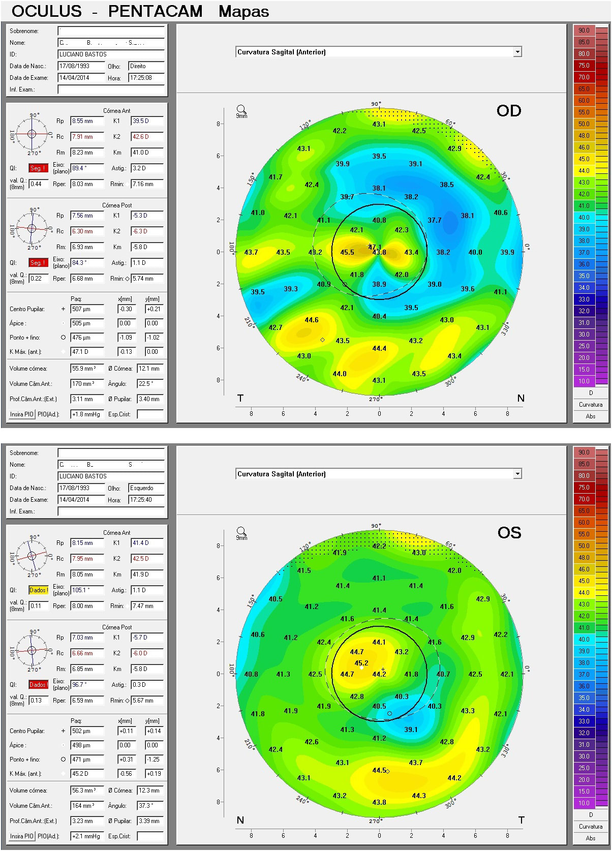 Figure 1. Anterior sagittal curvature maps OD and OS.