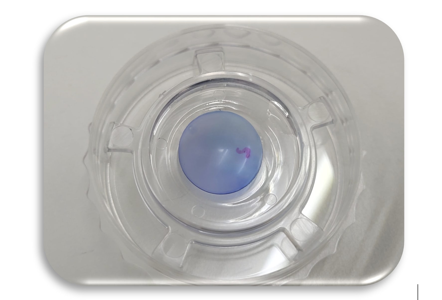 Figure 1: Example of a PVEK graft before being loaded into a glass injector.