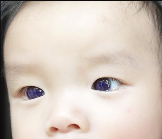 Baby Face