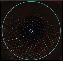 FIGURE 3: Smooth tear film, as captured by Ocular Surface Dynamics. IMAGE COURTESY DEE STEPHENSON, MD, FACS, ABES, FSEE