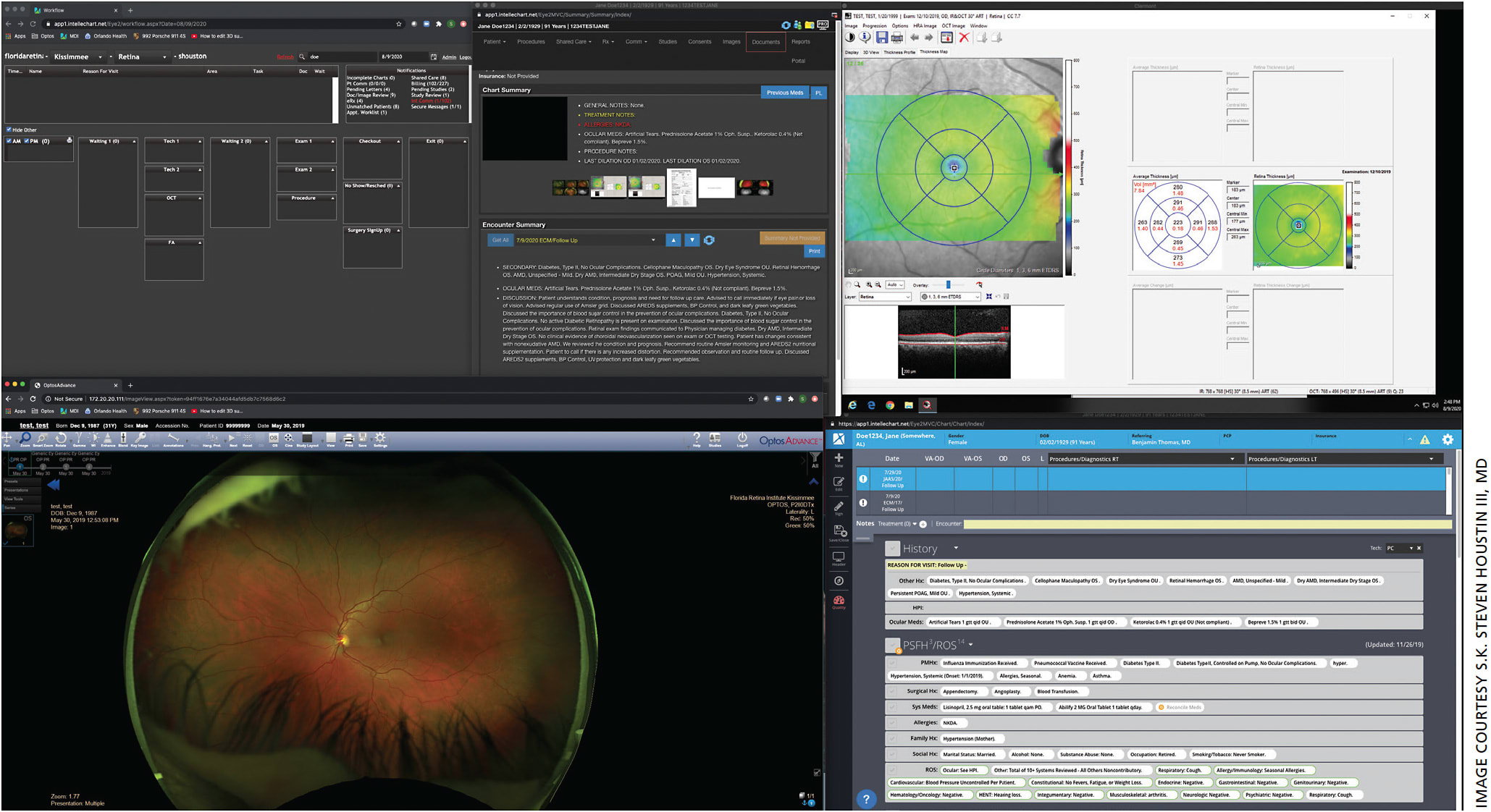 Figure. My monitor layout, either using one large monitor (>28”) or two connected monitors. Information is displayed to enhance efficiency and allow me to assimilate the information rapidly. I can view the prior note, SD-OCT scans (Heidelberg Spectralis), UWF images (Optos) and the current history and patient data and make complex decisions within seconds prior to entering the room with a patient.