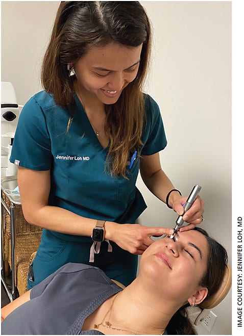 Jennifer Loh, MD, demonstrates the use of BlephEx on her staff.