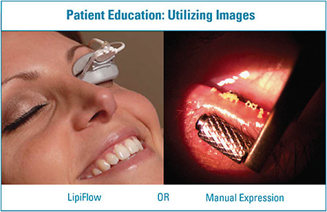 Figure 1. Images can be helpful when discussing treatment options with patients.