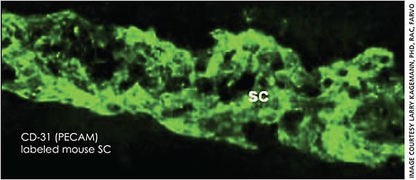 Figure 6. The nodular morphology of Schlemm’s canal observed in both resin and “virtual castings” is confirmed in an endothelial staining in a mouse eye.