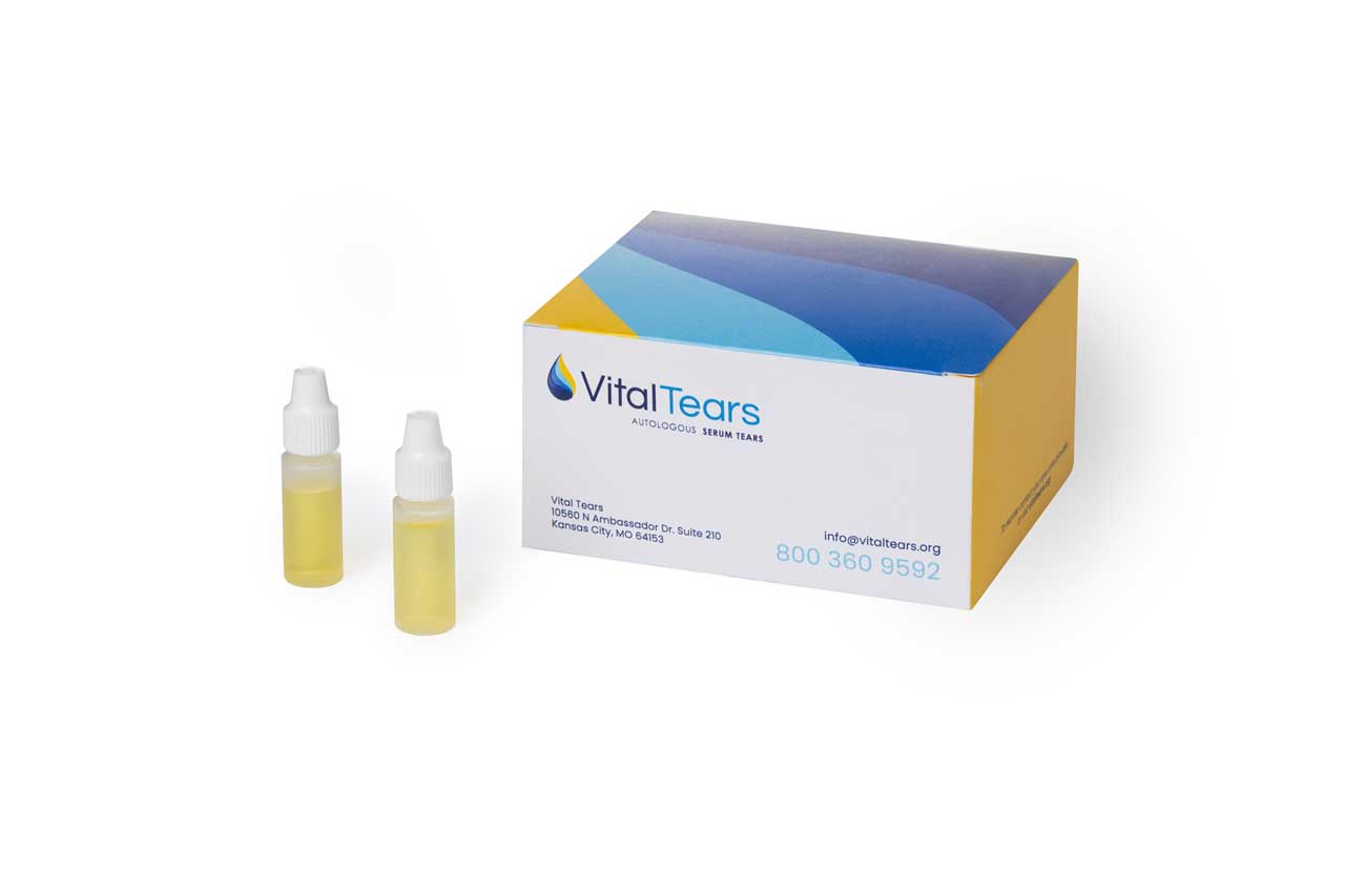 Image courtesy of Vital Tears