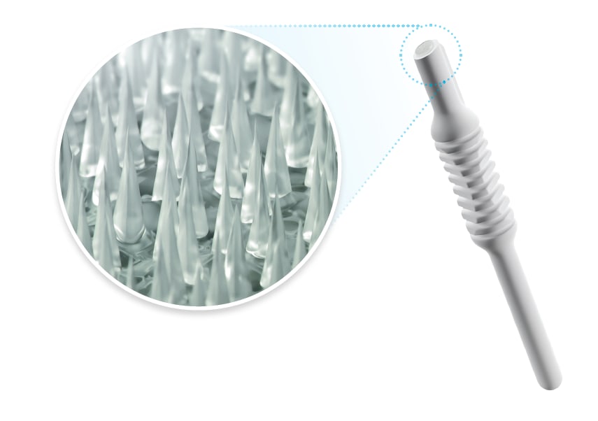 Plexitome is a new device for anterior stromal puncture.