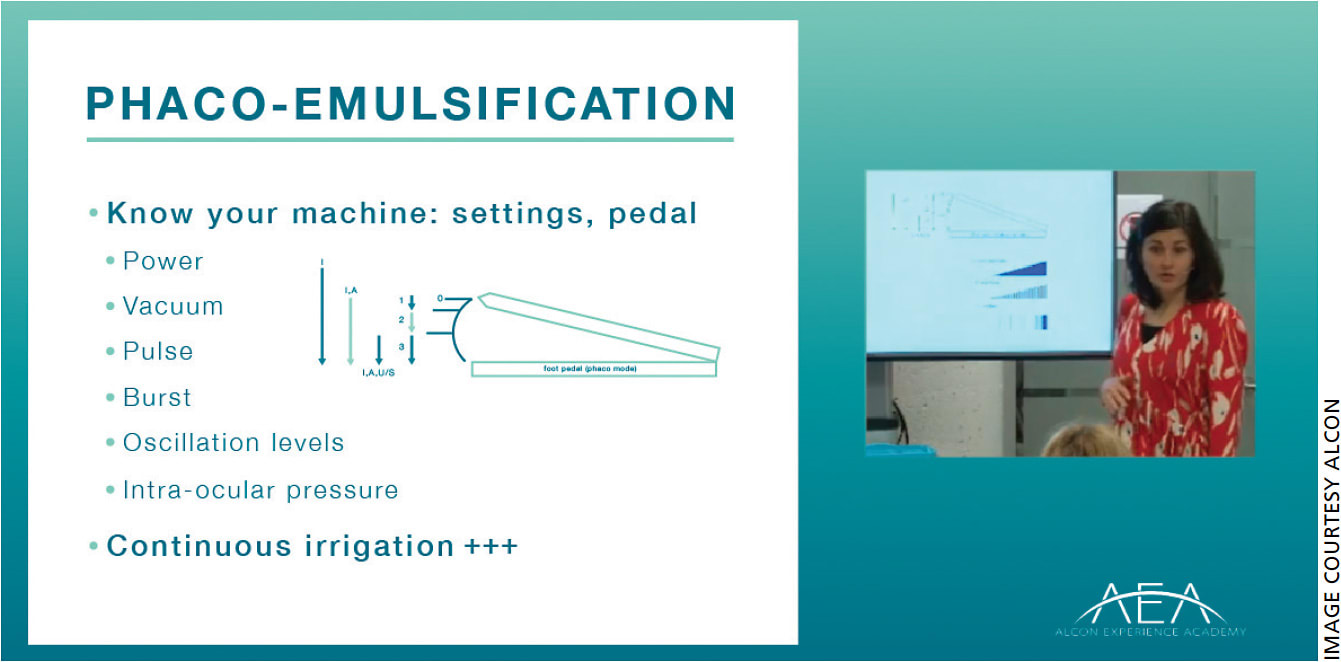 A still image from one of the instructional videos available at the Alcon Experience Academy website.