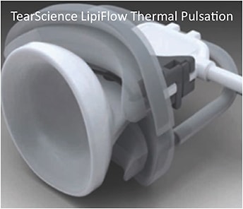 Figure 2. Thermal pulsation improves meibomian gland physiology.
