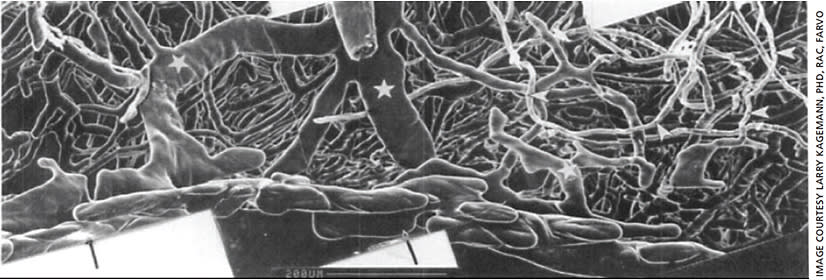 Figure 3. Resin castings out the outflow pathway provide visualization of Schlemm’s canal (bottom) as a nodular structure.