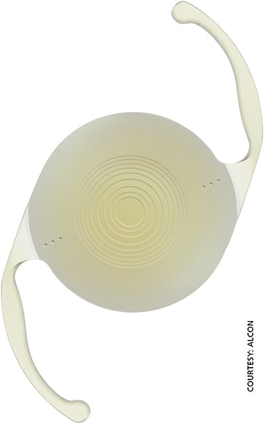 Alcon’s IQ ReSTOR multifocal toric IOL