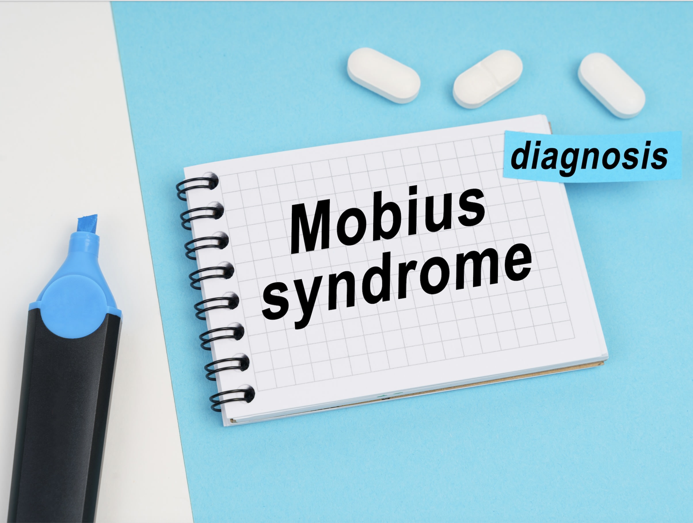 Mobius syndrome is a common masquerader of a true cranial nerve palsy (Photo credit: AdobeStock/Dzmitry)