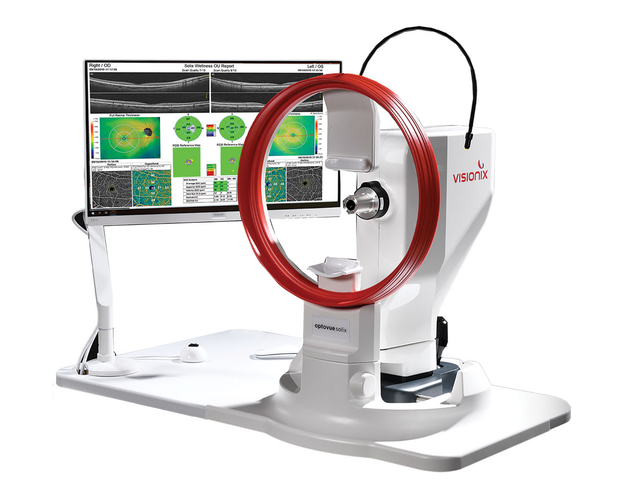 The Optovue Solix FullRange  OCT, from Visionix, provides detailed images of the anterior and posterior segment.  (Photo courtesy: Visionix)