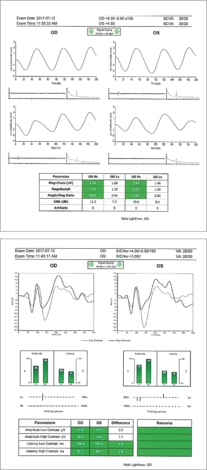 Examples of normal PERG (top) and VEP (bottom).
Courtesy of Nathan Lighthizer, O.D., F.A.A.O.