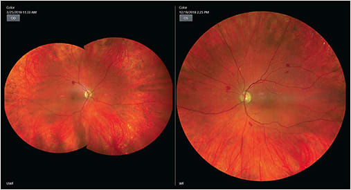 Image courtesy Joan Miller, OD