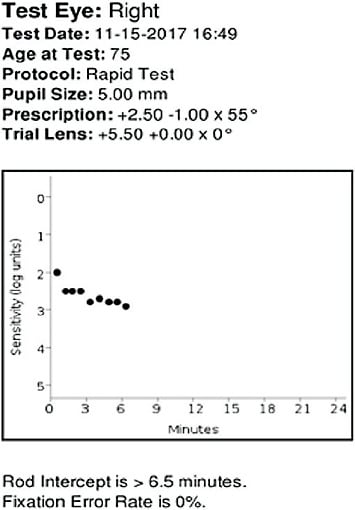 Figure 1. The abnormal dark adaptation test result indicates AMD.