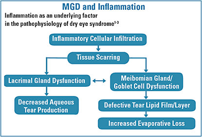 Figure 1. Inflammation plays a role in both tear-deficient and evaporative dry eye disease.