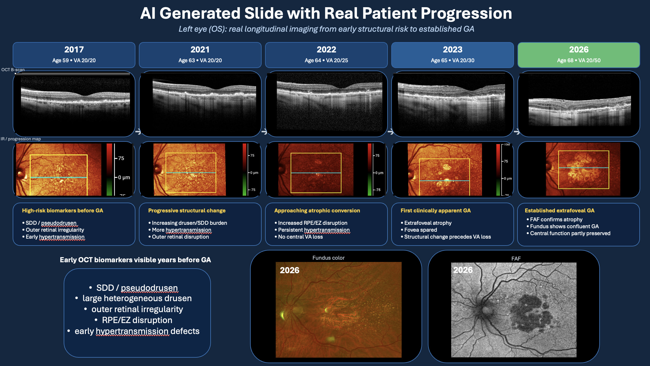 Figure 2. The left eye of a patient showing real longitudinal imaging from early structural risk to established GA.