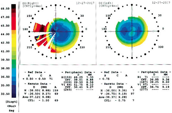 Topopgraphy 1
Image courtesy of Dr. Jason Miller