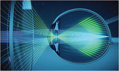 Image courtesy of Essilor.