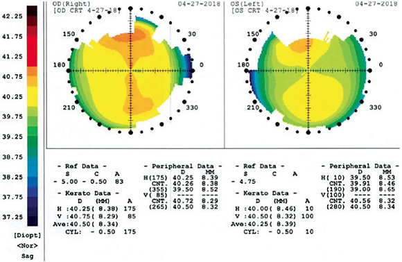 Topopgraphy 2
Image courtesy of Dr. Jason Miller