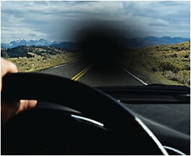 Image courtesy of Bausch + Lomb.