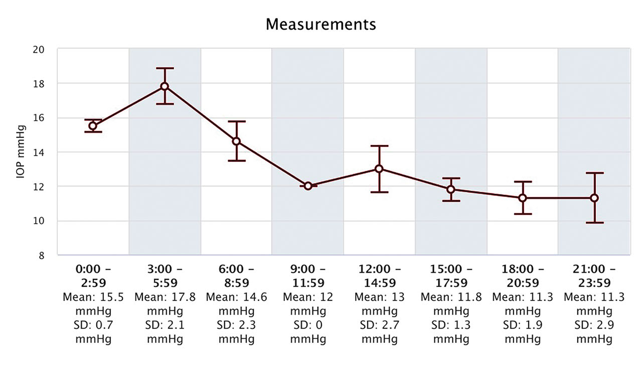 Note how home tonometry revealed increased IOP in this patient between 3 AM and 6 AM. (Photo courtesy: Dr. Cymbor)