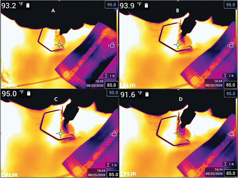 Figure 1. Thermal images of suprachoroidal administration of RGX-314 (Regenxbio) before dose administration (A), 18 seconds after administration (B), 21 seconds after administration (C), and 32 seconds after administration (D). Note the diffusely spreading temperature gradient within the quadrant of administration, correlating with distribution within the suprachoroidal space.