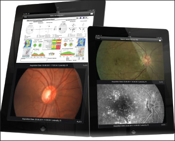 Figure 2. iPad and tablet functions make PACS solutions easy to mobilize and access in the clinic.