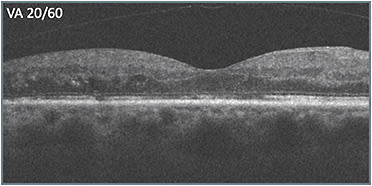 D: Status after treatment switch to different class