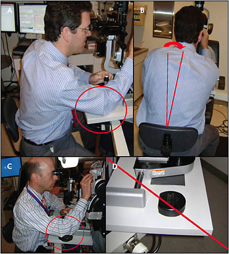 Figure 3. The physician should not place the elbow on a hard surface or bend sideways in the chair (A, B). It is better to use a soft cushion to decrease the contact stress on the elbow (C). Avoid using the hard lens case as an elbow rest (D). Additionally, it is better to move the chair instead of leaning the torso from side to side while using the slit lamp. 
REPRINTED WITH PERMISSION FROM THE AMERICAN ACADEMY OF OPHTHALMOLOGY.
