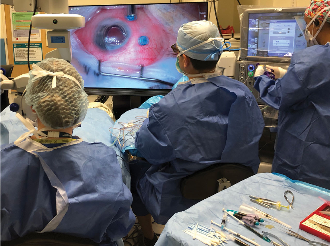 <p><strong>Figure 2. </strong>Customizable user interface on the Ngenuity 3D heads-up visualization system (Alcon) allows for the real-time optimization of brightness, contrast, and magnification. <em>Image courtesy John B. Miller, MD.</em></p>