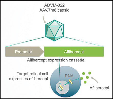 Figure 2.  The mechanism of the ADVM-022 gene therapy (Adverum Biotechnologies), which aims to treat neovascular AMD by delivering long-term expression of therapeutic levels of anti-VEGF protein. IMAGE COURTESY OF ADVERUM BIOTECHNOLOGIES