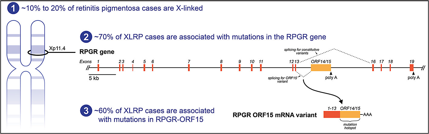 Figure 2. X-linked retinitis pigmentosa (XLRP) and the RPGR-ORF15 messenger RNA (mRNA) variant. Schematic representations of the RPGR genomic locus and the RPGR ORF15 mRNA variant that is expressed in photoreceptor cells. Approximately 10% to 20% of retinitis pigmentosa cases are linked to the X chromosome, and of these, approximately 70% are caused by mutations in the RPGR gene.2-5 Full-length RPGR mRNA that does not include ORF15 is expressed in a variety of cell types.10 Alternate splicing creates an RPGR-ORF15 mRNA variant that is expressed in photoreceptor cells.11-13 Approximately 60% of XLRP cases are caused by mutations in the ORF15 region.13
