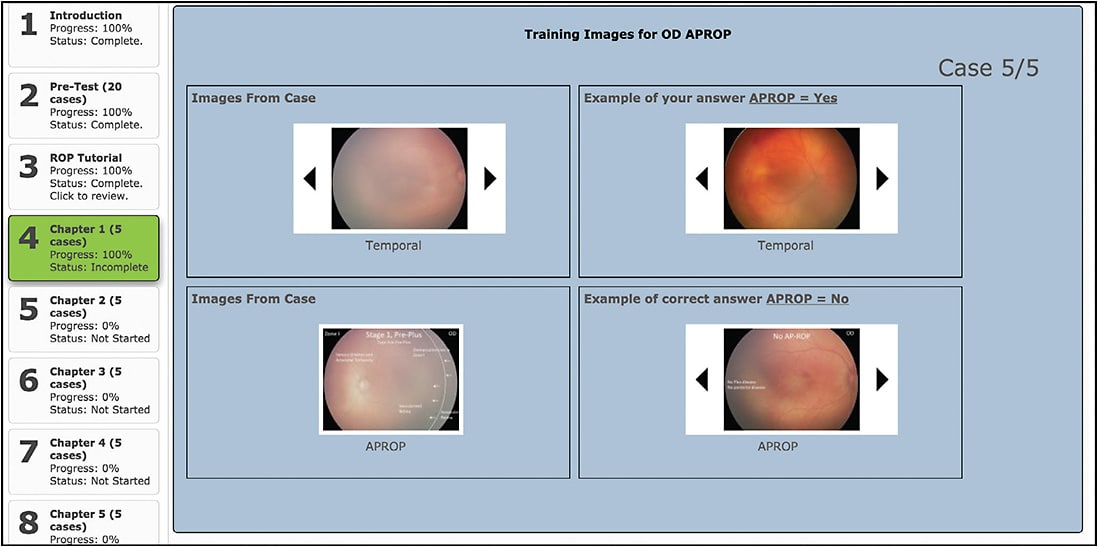 Figure 2. Individualized feedback following completion of each chapter of the retinopathy of prematurity learning system.
