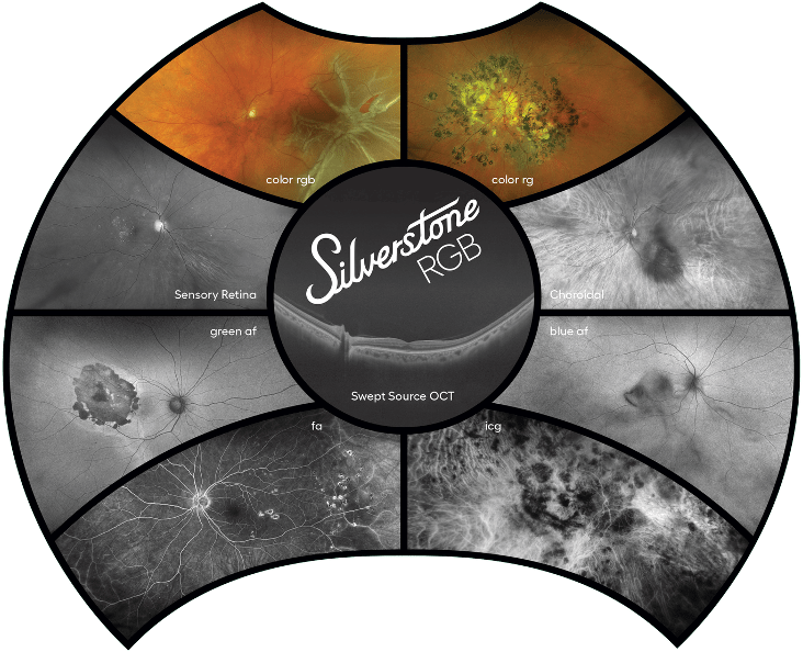 The Silverstone RGB features 9 imaging modalities, and brings together the full spectrum of retinal imaging capabilities, enabling clinicians to capture, visualize, and analyze pathology across every layer of the retina.