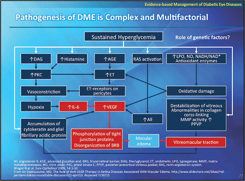FIGURE 1. Sustained hyperglycemia from diabetes causes a complex cascade of responses leading to a wide range of complications, including diabetic macular edema.