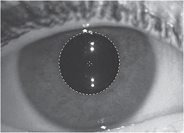 Figure 2. Relatively large pupil size (> 4.0mm) typical of a child’s eye measured under normal room illumination.