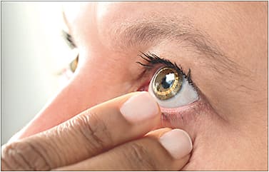 Figure 1. Contact lens with strain gauge sensor. Courtesy of Sensimed AG