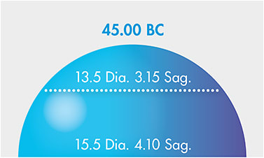 Figure 1. As noted in this simulation, corneas and contact lenses with similar central curvatures can have very different sagittal depths due to overall diameter differences. Image courtesy of Al Vaske