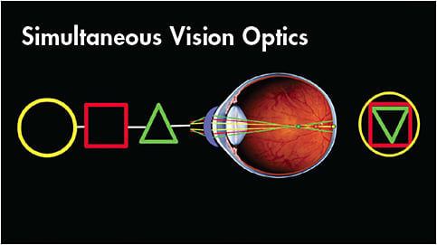 Figure 1. Simultaneous vision presents both distance and near vision at the same time.