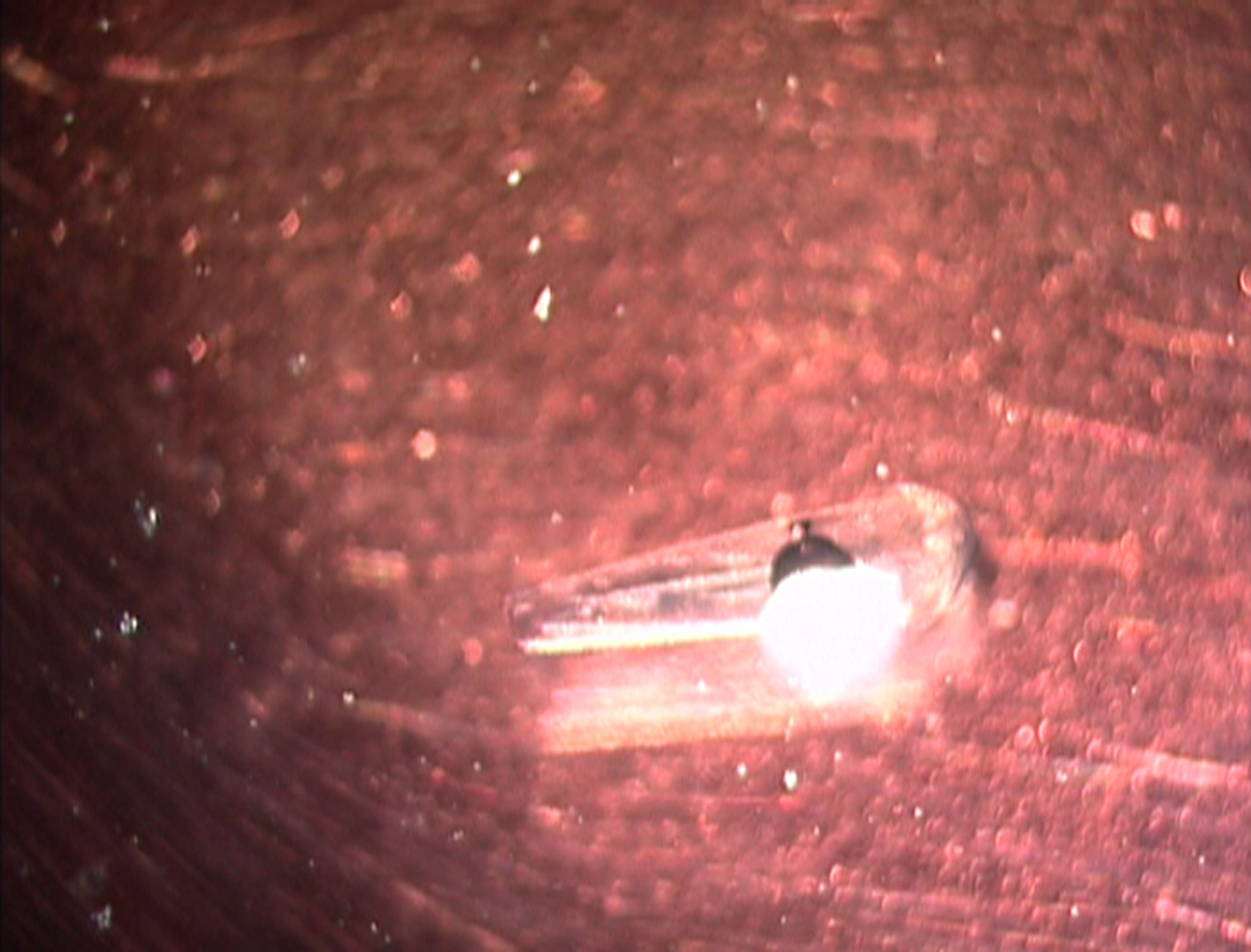 Figure 3: The harvested donor graft is placed in corneal storage medium (McCarey Kaufman -MK medium) in a bowl.
